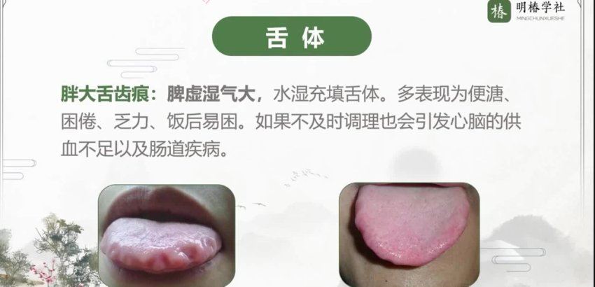 杨舒-十二脏腑调养160节 (76.09G)