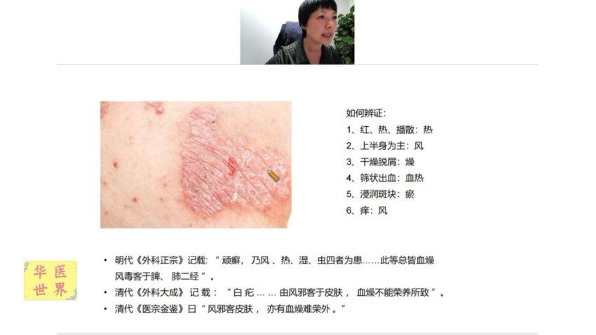 皮肤病名医训练营--跟名医学经方系列课 (5.21G)